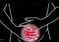 Menstruasi