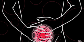 Menstruasi